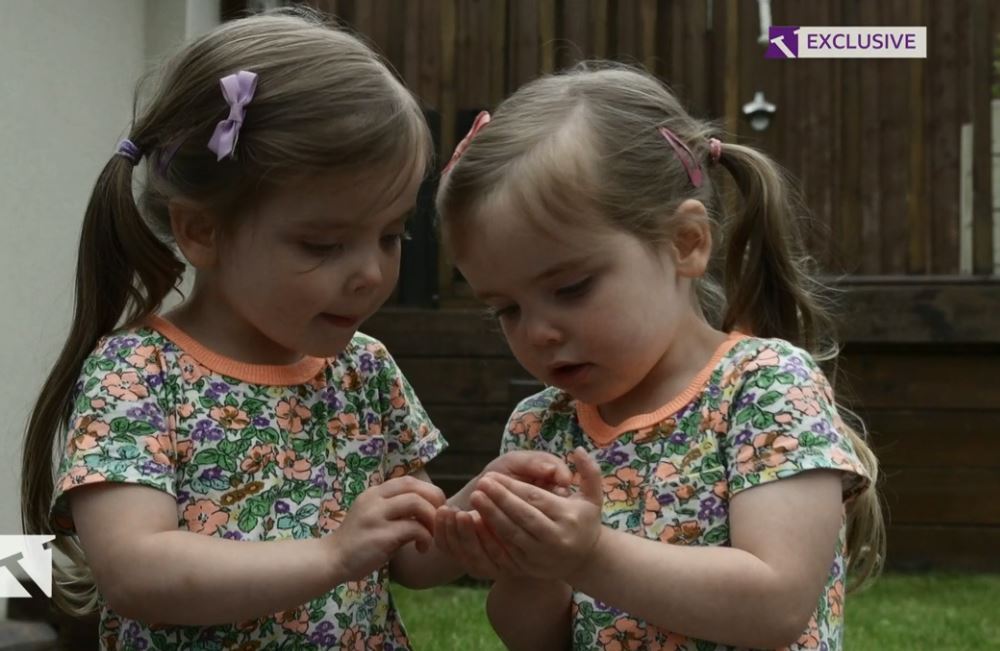 Jessica and Jasmine 'barely slept' and their parents struggled to keep down a job due to sheer exhaustion