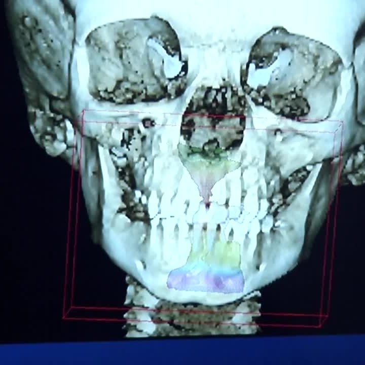Your Healthy Family Your Healthy Family: Correct breathing stops 4-year-old from snoring 4:52 – KOAA.com Colorado Springs and Pueblo News