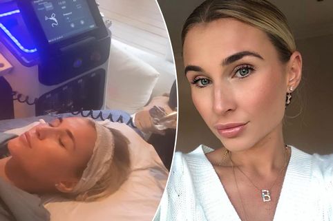 Billie Faiers facial