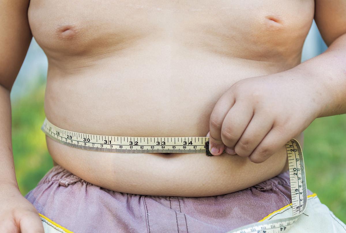 Addressing the childhood obesity epidemic